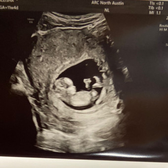 Babylist Registry Photo.