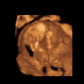 Babylist Registry Photo.