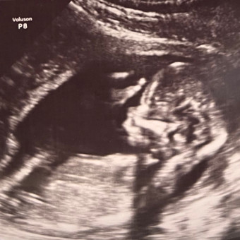 Babylist Registry Photo.