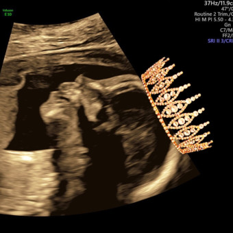 Babylist Registry Photo.