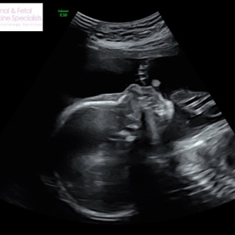 Babylist Registry Photo.
