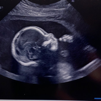 Babylist Registry Photo.