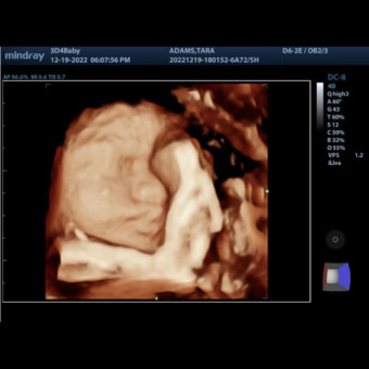 Babylist Registry Photo.