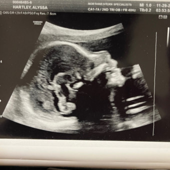 Babylist Registry Photo.