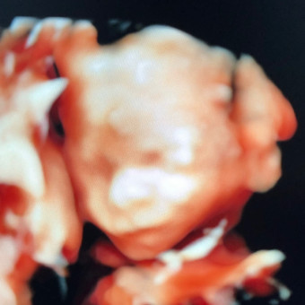 Babylist Registry Photo.