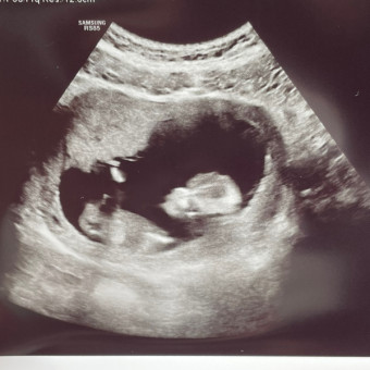 Babylist Registry Photo.