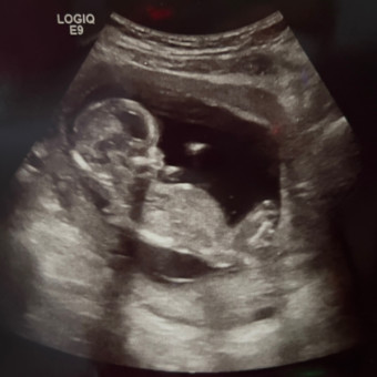 Babylist Registry Photo.