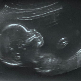 Babylist Registry Photo.