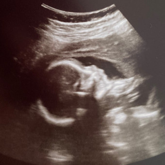 Babylist Registry Photo.