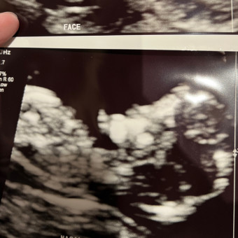 Alex and Kody’s Baby Registry Photo.