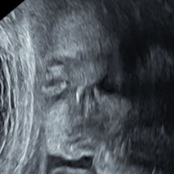 Babylist Registry Photo.