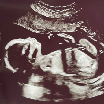Babylist Registry Photo.