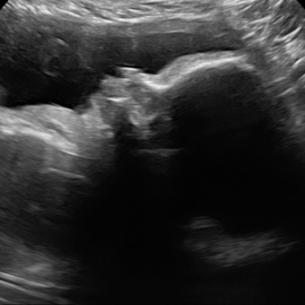 Babylist Registry Photo.