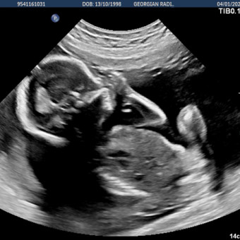 Babylist Registry Photo.