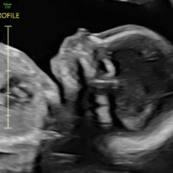 Babylist Registry Photo.