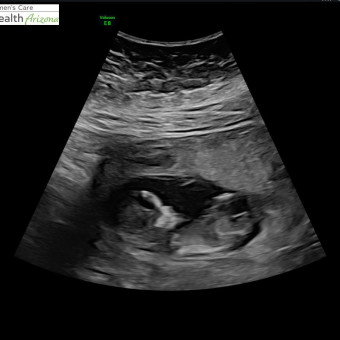 Babylist Registry Photo.