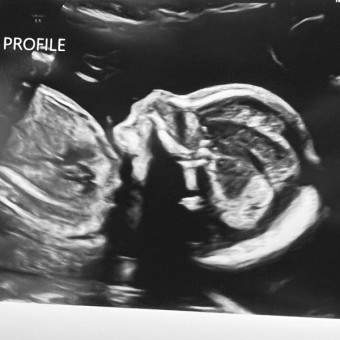 Babylist Registry Photo.
