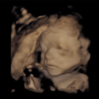 Babylist Registry Photo.