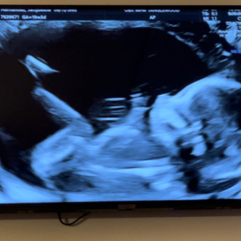 Babylist Registry Photo.