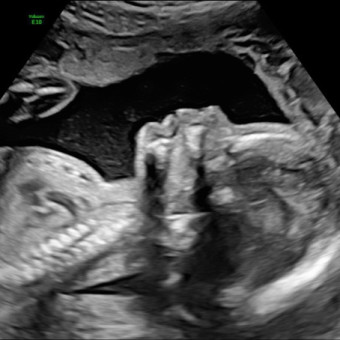Babylist Registry Photo.