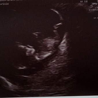 Babylist Registry Photo.