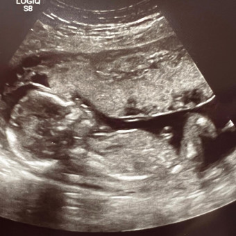 Babylist Registry Photo.