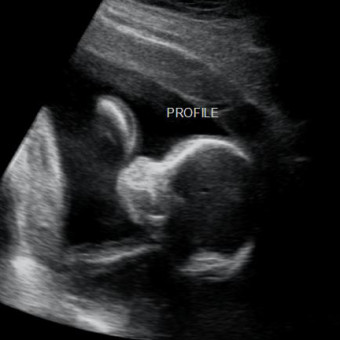 Babylist Registry Photo.