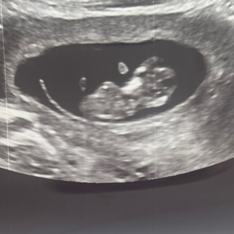 Lacey & Eric’s Baby Registry Photo.
