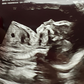 Babylist Registry Photo.