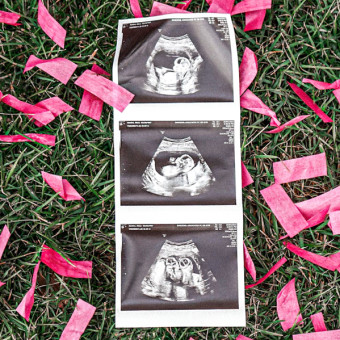 Babylist Registry Photo.