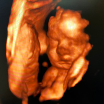 Babylist Registry Photo.