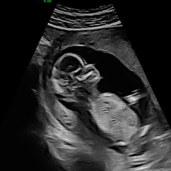 Babylist Registry Photo.