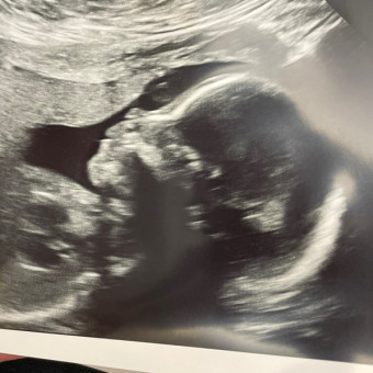 Babylist Registry Photo.