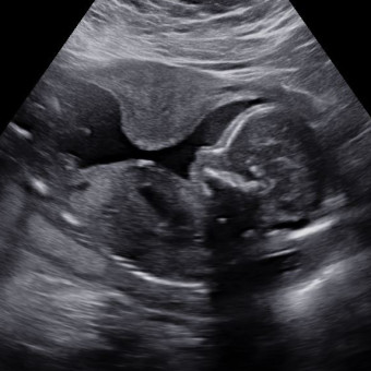 Babylist Registry Photo.