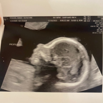Babylist Registry Photo.
