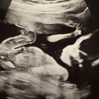 Babylist Registry Photo.