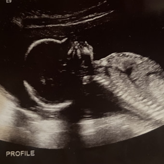 Babylist Registry Photo.
