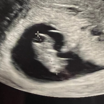 Babylist Registry Photo.
