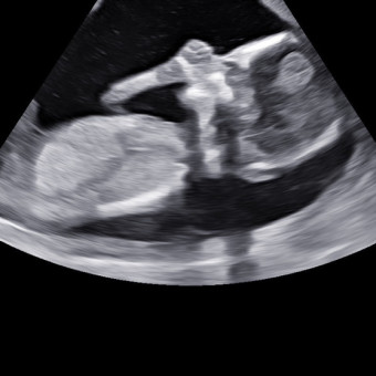 Babylist Registry Photo.