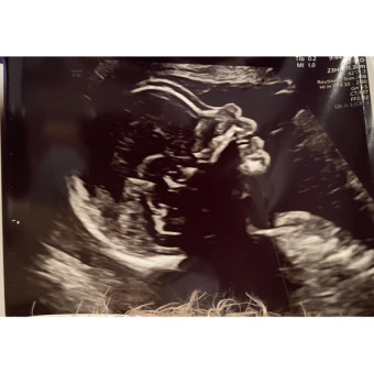 Babylist Registry Photo.