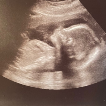 Babylist Registry Photo.