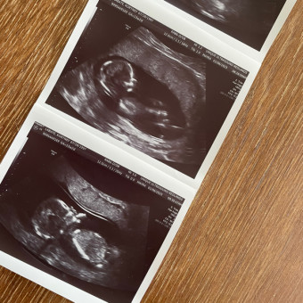 Kortney & Nicks Baby Registry Photo.