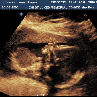 Babylist Registry Photo.