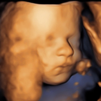 Babylist Registry Photo.