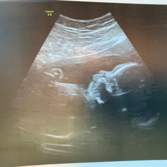 Babylist Registry Photo.
