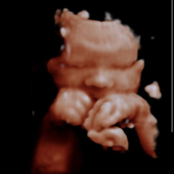 Babylist Registry Photo.