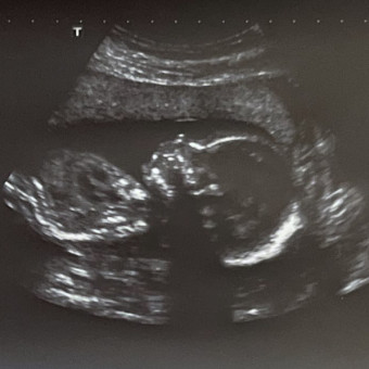 Babylist Registry Photo.