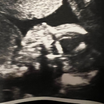Babylist Registry Photo.