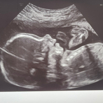 Babylist Registry Photo.
