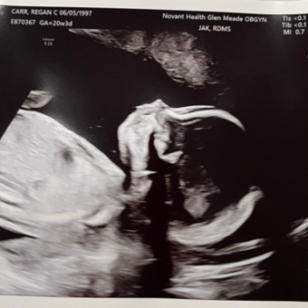 Babylist Registry Photo.
